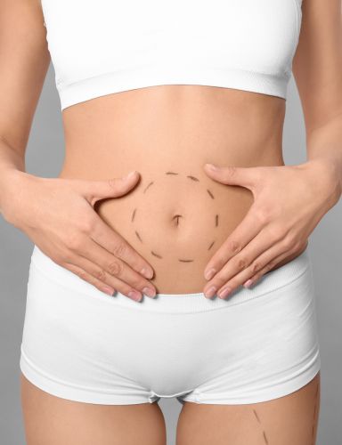 The Difference Between Liposuction and Tummy Tuck